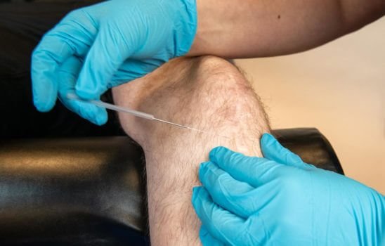 Litteken Fysiotherapie